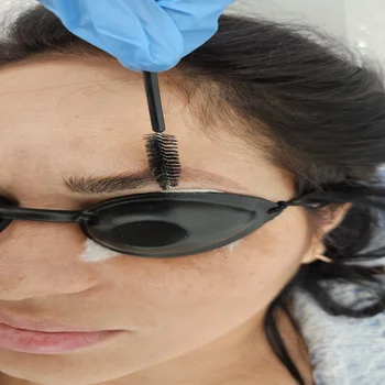 Laser Tattoo Removal Coral Gables 